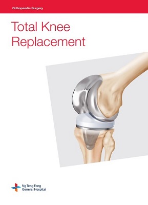 Total Knee Replacement